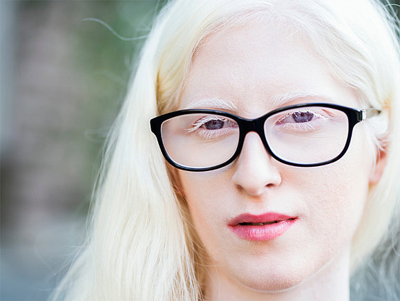 Close-Up von Frau mit sehr hellen Haaren und Haut, die eine Brille trägt.